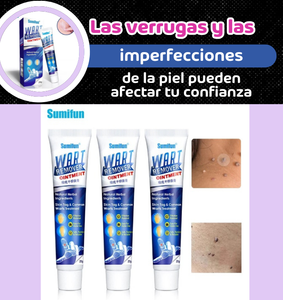 REMOVEDOR DE VERRUGAS