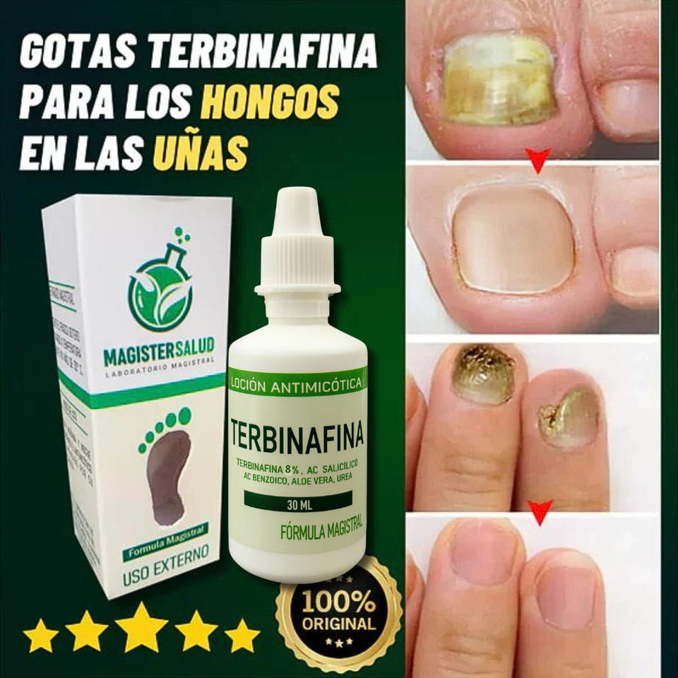 TERBINAFINA GOTAS PARA HONGOS